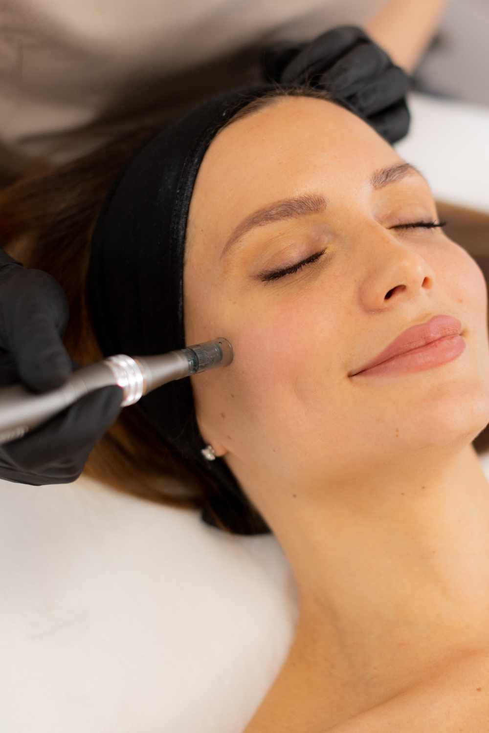 skin treatments at PRALASH Dermystique Bangalore
