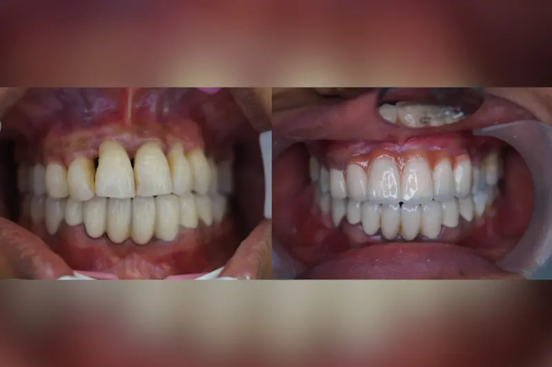 Digital Smile Designing Bangalore