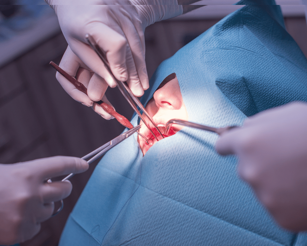 Mucogingival surgery and gum grafting in Bangalore at PRALASH