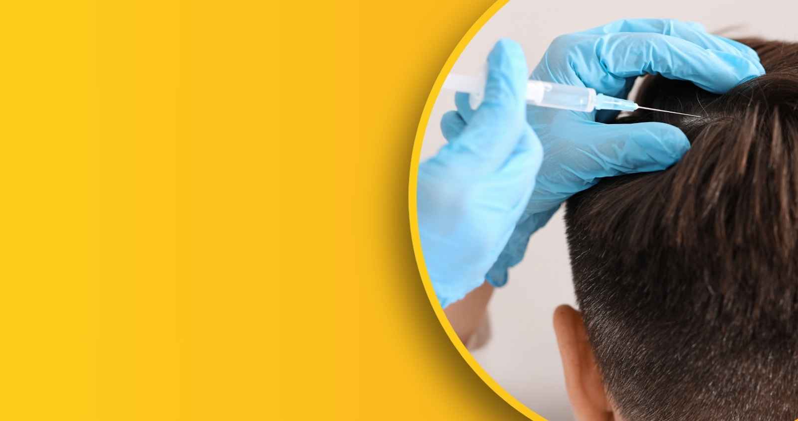 Non-surgical hair replacement wigs and hair patches at PRALASH Clinic Bangalore