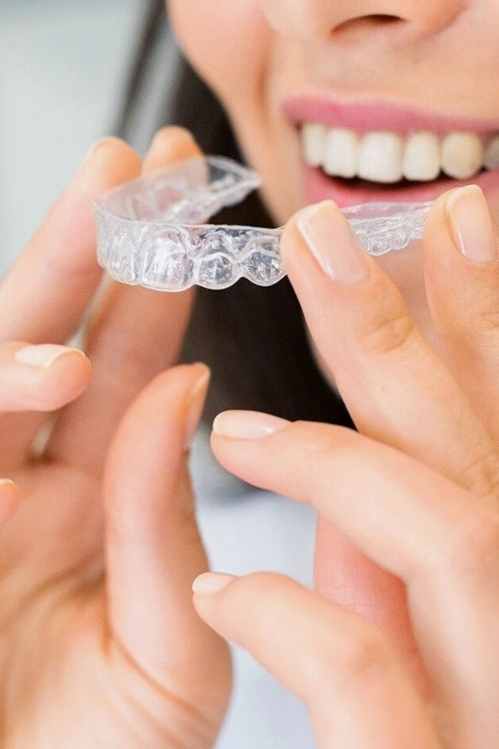 How invisible aligners work - clear aligner treatment process in Kalyan Nagar
