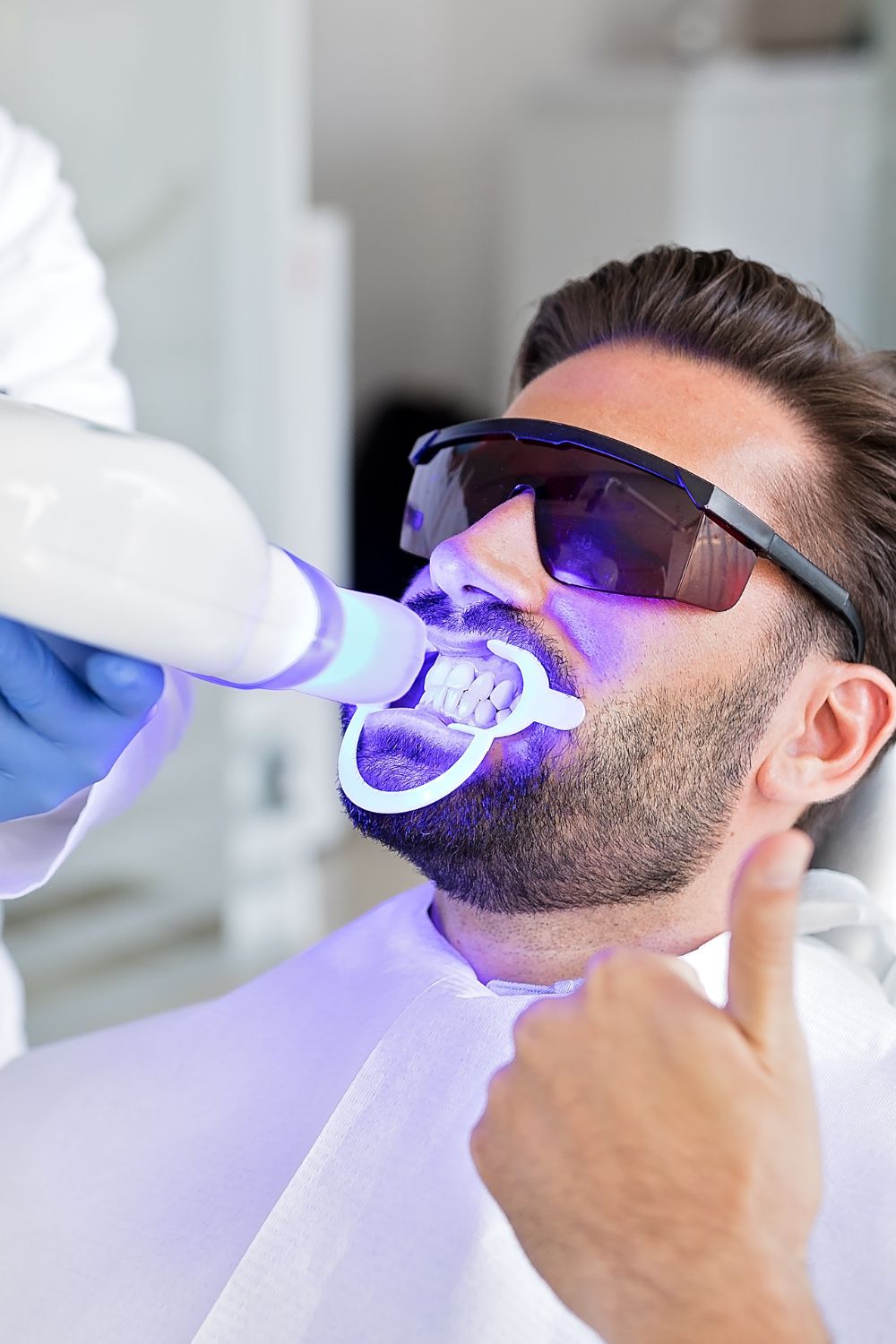 How teeth whitening works - step by step whitening process in Kalyan Nagar Bangalore