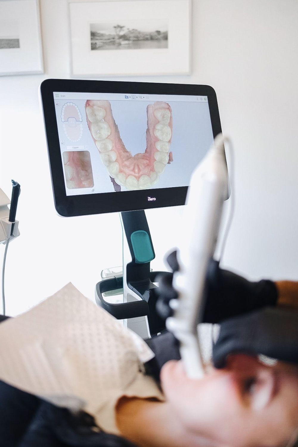 CAD/CAM Dentistry in Bangalore at PRALASH