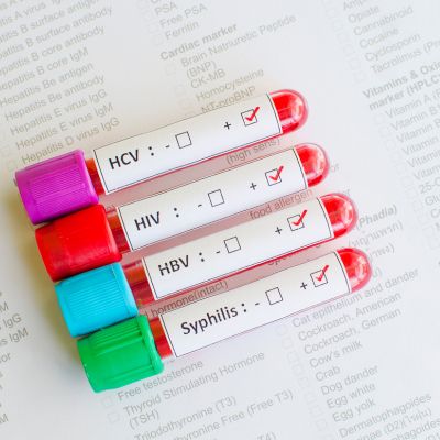  sexually transmitted disease (STD)