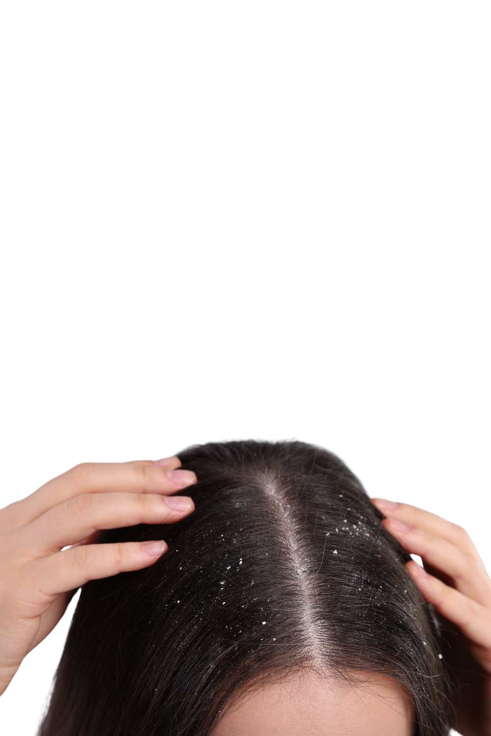 Scalp treatment at PRALASH HRBR Layout Bangalore