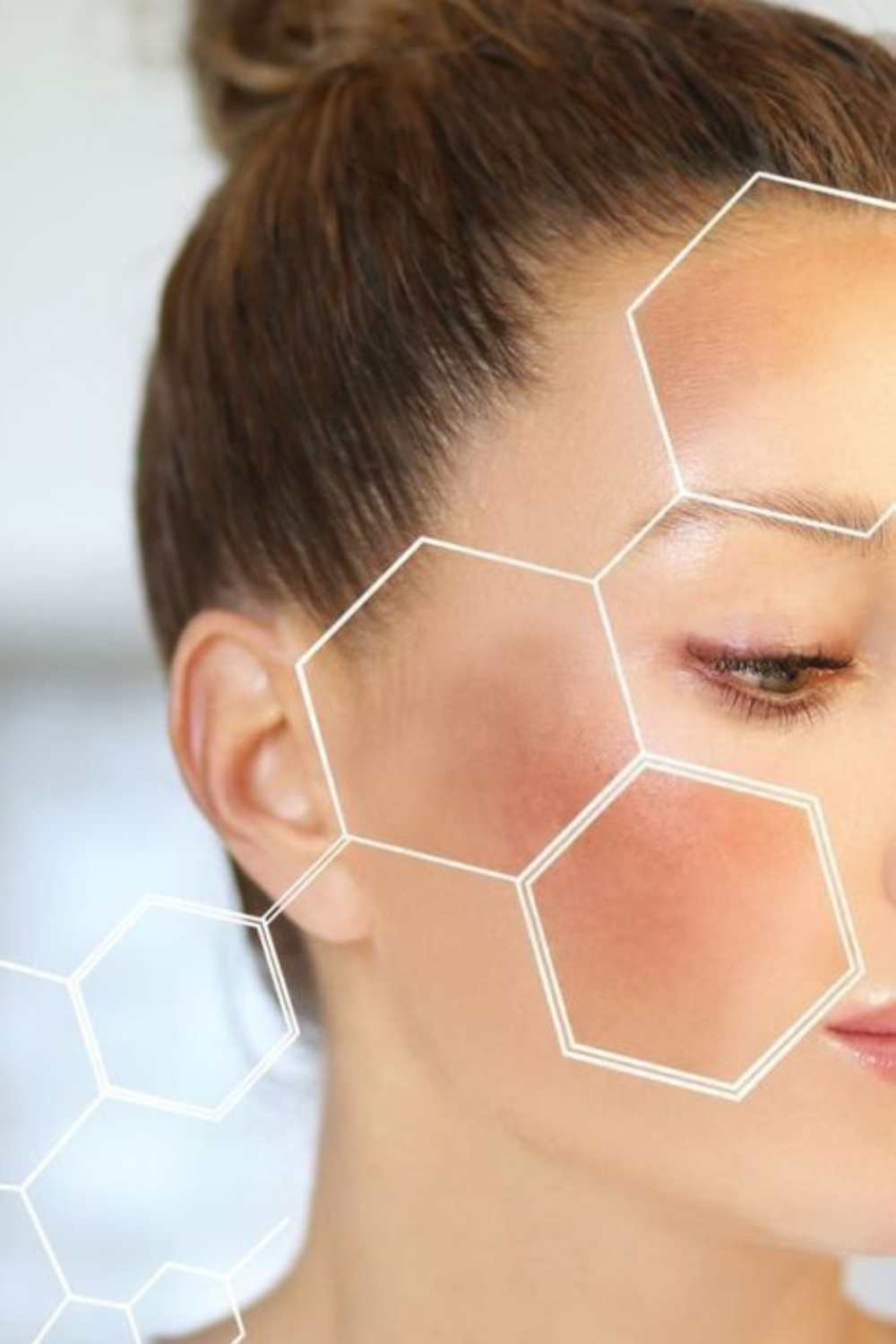 Pigmentation treatment process in Bangalore