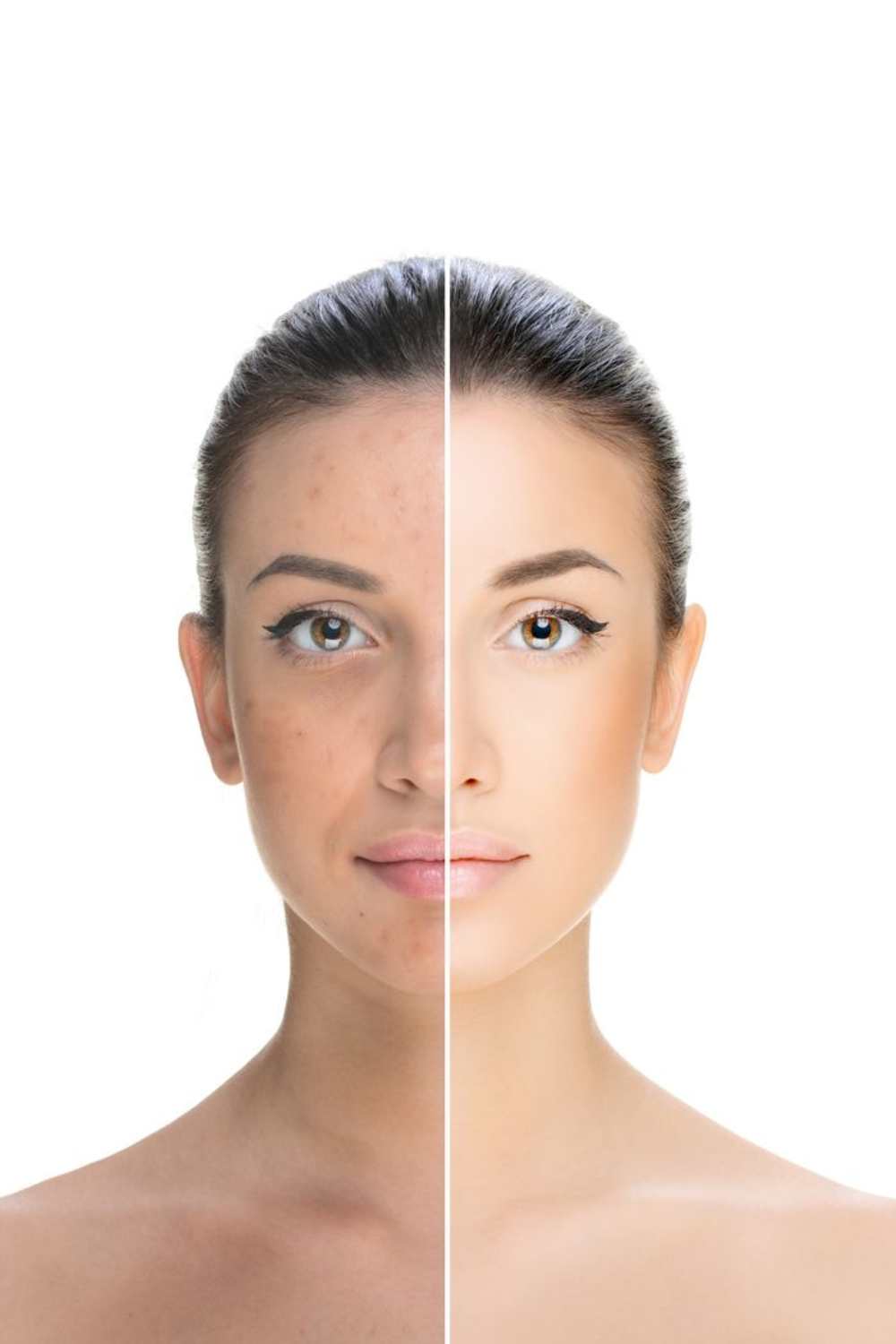 Skin brightening treatment process in Bangalore