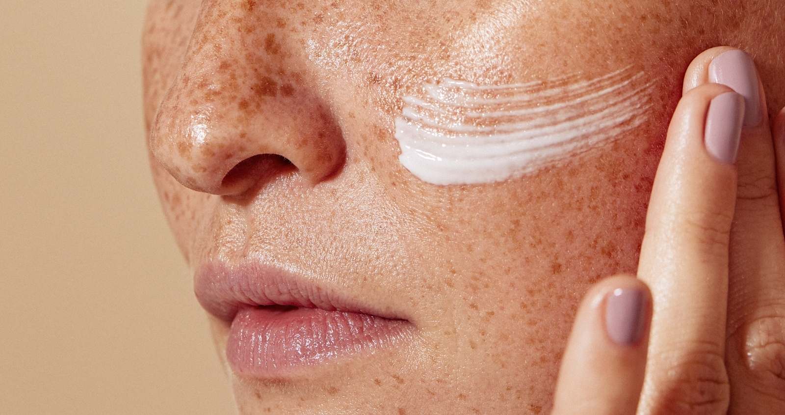 Pigmentation treatment at PRALASH HRBR Layout Bangalore